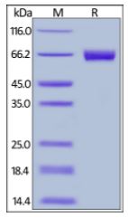 Human Mesothelin (296-580), Fc Tag on SDS-PAGE under reducing (R) and non-reducing (NR) conditions. The gel was stained overnight with Coomassie Blue. The purity of the protein is greater than 95%.
